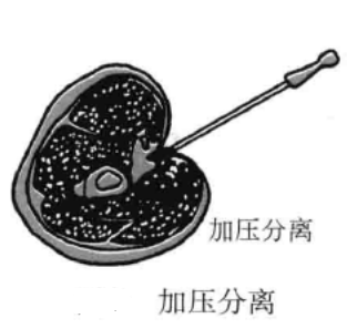 针刀操作技巧 初学者必看